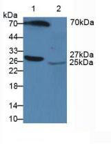 APCS / Serum Amyloid P / SAP Antibody - Western Blot; Sample: Lane1: Human Serum; Lane2: Human Urine.