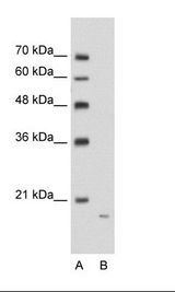 APCS / Serum Amyloid P / SAP Antibody - A: Marker, B: Jurkat Cell Lysate.  This image was taken for the unconjugated form of this product. Other forms have not been tested.