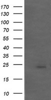 APCS / Serum Amyloid P / SAP Antibody - HEK293T cells were transfected with the pCMV6-ENTRY control (Left lane) or pCMV6-ENTRY APCS (Right lane) cDNA for 48 hrs and lysed. Equivalent amounts of cell lysates (5 ug per lane) were separated by SDS-PAGE and immunoblotted with anti-APCS.