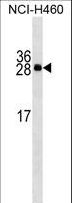 APCS / Serum Amyloid P / SAP Antibody - APCS Antibody western blot of NCI-H460 cell line lysates (35 ug/lane). The APCS antibody detected the APCS protein (arrow).