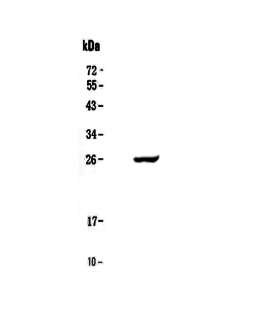 APCS / Serum Amyloid P / SAP Antibody - Western blot - Anti-Serum Amyloid P Picoband antibody