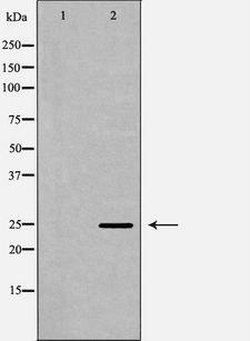 APCS / Serum Amyloid P / SAP Antibody - Western blot analysis of extracts of human kidney tissue using APCS antibody. The lane on the left is treated with the antigen-specific peptide.