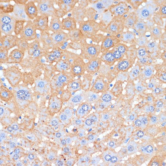 APCS / Serum Amyloid P / SAP Antibody - Immunohistochemistry of paraffin-embedded Mouse liver using APCS Polyclonal Antibody at dilution of 1:100 (40x lens).