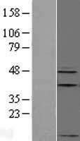 Apelin Protein - Western validation with an anti-DDK antibody * L: Control HEK293 lysate R: Over-expression lysate