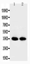 APEX1 / APE1 Antibody - WB of APEX1 / APE1 antibody. All lanes: Anti-APEX1 at 0.5ug/ml. Lane 1: Rat Brain Tissue Lysate at 40ug. Lane 2: Mouse Brain Tissue Lysate at 40ug. Predicted bind size: 35KD. Observed bind size: 35KD.