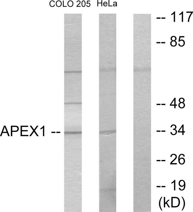 APEX1 / APE1 Antibody - Western blot analysis of lysates from COLO205 and HeLa cells, using APEX1 Antibody. The lane on the right is blocked with the synthesized peptide.