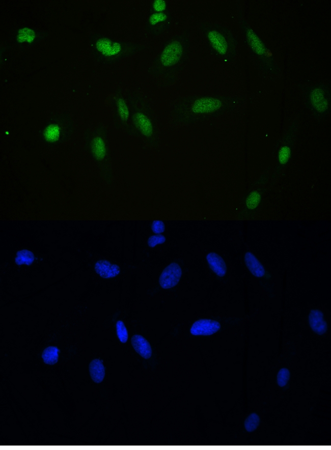 APEX1 / APE1 Antibody - IF analysis of APEX1 using anti-APEX1 antibody APEX1 was detected in immunocytochemical section of U20S cell. Enzyme antigen retrieval was performed using IHC enzyme antigen retrieval reagent for 15 mins. The tissue section was blocked with 10% goat serum. The tissue section was then incubated with 2µg/mL rabbit anti-APEX1 Antibody overnight at 4°C. DyLight®488 Conjugated Goat Anti-Rabbit IgG was used as secondary antibody at 1:100 dilution and incubated for 30 minutes at 37°C. The section was counterstained with DAPI. Visualize using a fluorescence microscope and filter sets appropriate for the label used.