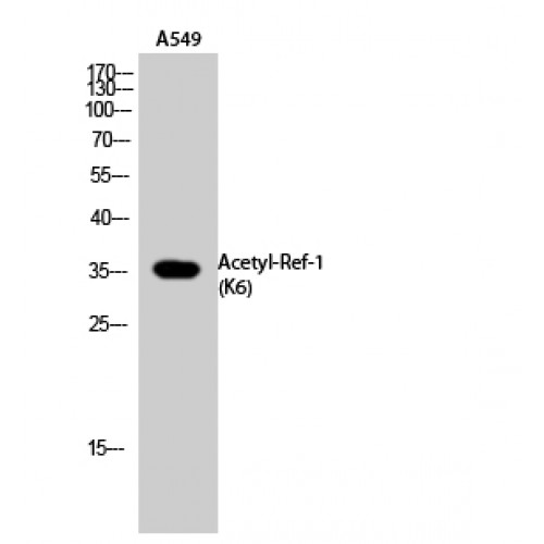 APEX1 / APE1 Antibody - Western blot of Acetyl-Ref-1 (K6) antibody