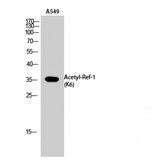 APEX1 / APE1 Antibody - Western blot of Acetyl-Ref-1 (K6) antibody