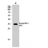 APEX1 / APE1 Antibody - Western blot of Acetyl-Ref-1 (K7) antibody