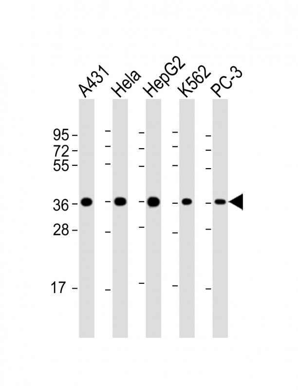 APEX1 / APE1 Antibody - All lanes: Anti-APEX1 Antibody at 1:2000 dilution. Lane 1: A431 whole cell lysate. Lane 2: HeLa whole cell lysate. Lane 3: HepG2 whole cell lysate. Lane 4: K562 whole cell lysate. Lane 5: PC-3 whole cell lysate Lysates/proteins at 20 ug per lane. Secondary Goat Anti-mouse IgG, (H+L), Peroxidase conjugated at 1:10000 dilution. Predicted band size: 36 kDa. Blocking/Dilution buffer: 5% NFDM/TBST.