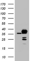 APEX1 / APE1 Antibody - HEK293T cells were transfected with the pCMV6-ENTRY control (Left lane) or pCMV6-ENTRY APEX1 (Right lane) cDNA for 48 hrs and lysed. Equivalent amounts of cell lysates (5 ug per lane) were separated by SDS-PAGE and immunoblotted with anti-APEX1.