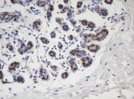 APEX1 / APE1 Antibody - IHC of paraffin-embedded Human breast tissue using anti-APEX1 mouse monoclonal antibody.