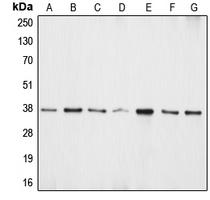 APEX1 / APE1 Antibody - Western blot analysis of APE1 expression in HeLa (A); Jurkat (B); SW480 (C); A431 (D); NIH3T3 (E); mouse kidney (F); rat lung (G) whole cell lysates.