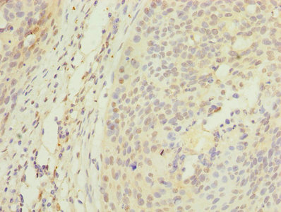 APEX1 / APE1 Antibody - Immunohistochemistry of paraffin-embedded human lungs tissue using APEX1 Antibody at dilution of 1:100