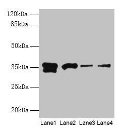 APEX1 / APE1 Antibody - Western blot All lanes: DNA- (apurinic or apyrimidinic site) lyase antibody at 2µg/ml Lane 1: Hela whole cell lysate Lane 2: Mouse brain tissue Lane 3: MCF-7 whole cell lysate Lane 4: HepG2 whole cell lysate Lane 5: Raji whole cell lysate Lane 6: A549 whole cell lysate Lane 7: K562 whole cell lysate Lane 8: Mouse liver tissue Lane 9: NIH/3T3 whole cell lysate Secondary Goat polyclonal to rabbit IgG at 1/15000 dilution Predicted band size: 36 kDa Observed band size: 36, 34, 21 kDa