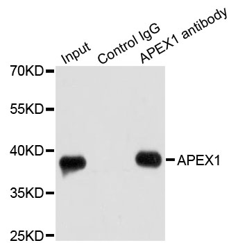 APEX1 / APE1 Antibody - Immunoprecipitation analysis of 200ug extracts of HeLa cells.