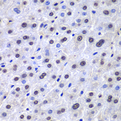 APEX1 / APE1 Antibody - Immunohistochemistry of paraffin-embedded human liver injury using APEX1 antibodyat dilution of 1:100 (40x lens).