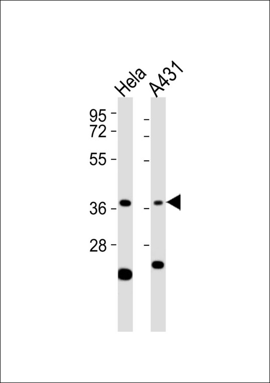 APEX1 / APE1 Antibody - All lanes : Anti-APE1 Antibody at 1:1000 dilution Lane 1: HeLa whole cell lysates Lane 2: A431 whole cell lysates Lysates/proteins at 20 ug per lane. Secondary Goat Anti-Rabbit IgG, (H+L),Peroxidase conjugated at 1/10000 dilution Predicted band size : 36 kDa Blocking/Dilution buffer: 5% NFDM/TBST.