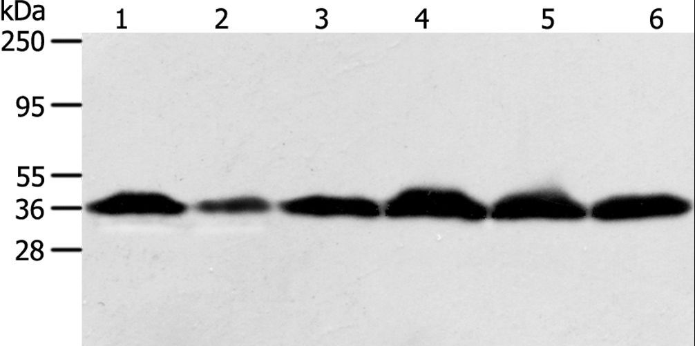 APEX1 / APE1 Antibody - Western blot analysis of HeLa cell and human liver cancer tissue, Raji, Jurkat, 293T and PC3 cell, using APEX1 Polyclonal Antibody at dilution of 1:450.