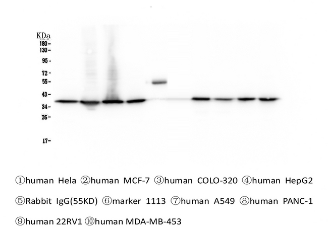 APEX1 / APE1 Antibody - Western blot analysis of APE1 using anti-APE1 antibody. Electrophoresis was performed on a 5-20% SDS-PAGE gel at 70V (Stacking gel) / 90V (Resolving gel) for 2-3 hours. The sample well of each lane was loaded with 50ug of sample under reducing conditions. Lane 1: human Hela whole cell lysates, Lane 2: human MCF-7 whole cell lysates, Lane 3: human COLO-320 whole cell lysates, Lane 4: human HepG2 whole cell lysates, Lane 5: Rabbit IgG, Lane 6: Marker 1113, Lane 7: human A549 whole cell lysates, Lane 8: human PANC-1 whole cell lysates, Lane 9: human 22RV1 whole cell lysates, Lane 10: human MDA-MB-453 whole cell lysates. After Electrophoresis, proteins were transferred to a Nitrocellulose membrane at 150mA for 50-90 minutes. Blocked the membrane with 5% Non-fat Milk/ TBS for 1.5 hour at RT. The membrane was incubated with mouse anti-APE1 antigen affinity purified monoclonal antibody at 0.5 µg/mL overnight at 4°C, then washed with TBS-0.1% Tween 3 times with 5 minutes each and probed with a Biotin Conjugated goat anti-mouse IgG secondary antibody at a dilution of 1:10000 for 1.5 hour at RT. The signal is developed using an Enhanced Chemiluminescent detection (ECL) kit with Tanon 5200 system.