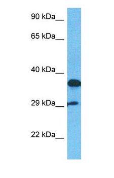 APEX1 / APE1 Antibody - Western blot of APEX1 Antibody with human Fetal Lung lysate.  This image was taken for the unconjugated form of this product. Other forms have not been tested.