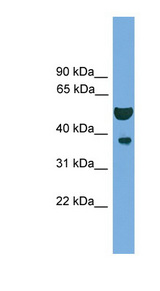 APEX1 / APE1 Antibody - APEX1 / APE1 antibody Western blot of MCF7 cell lysate. This image was taken for the unconjugated form of this product. Other forms have not been tested.