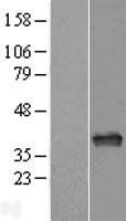 APEX1 / APE1 Protein - Western validation with an anti-DDK antibody * L: Control HEK293 lysate R: Over-expression lysate