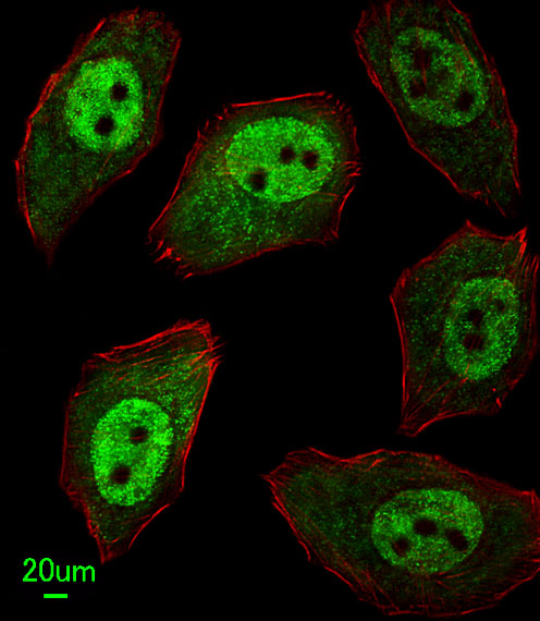 APEX2 Antibody - Immunofluorescence of U251 cells, using APEX2 Antibody. Antibody was diluted at 1:25 dilution. Alexa Fluor 488-conjugated goat anti-rabbit lgG at 1:400 dilution was used as the secondary antibody (green). Cytoplasmic actin was counterstained with Dylight Fluor 554 (red) conjugated Phalloidin (red).