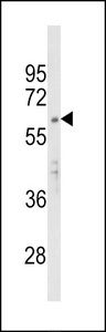 APEX2 Antibody - Western blot of APEX2 Antibody in MCF-7 cell line lysates (35 ug/lane). APEX2 (arrow) was detected using the purified antibody.