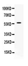 APEX2 Antibody - Western blot - Anti-APEX2/Ape2 Picoband Antibody