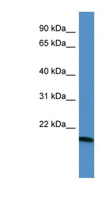 APG12 / ATG12 Antibody - ATG12 antibody Western blot of Rat Kidney lysate. This image was taken for the unconjugated form of this product. Other forms have not been tested.