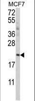 APG12 / ATG12 Antibody - Western blot of hAPG12L-T23 in MCF-7 cell line lysates (35 ug/lane). APG12L (arrow) was detected using the purified antibody.