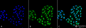 APG12 / ATG12 Antibody - Immunocytochemistry/Immunofluorescence analysis using Rabbit Anti-ATG12 Polyclonal Antibody. Tissue: Cervical cancer cell line (HeLa). Species: Human. Fixation: 4% Formaldehyde for 15 min at RT. Primary Antibody: Rabbit Anti-ATG12 Polyclonal Antibody  at 1:100 for 60 min at RT. Secondary Antibody: Goat Anti-Rabbit ATTO 488 at 1:100 for 60 min at RT. Counterstain: DAPI (blue) nuclear stain at 1:5000 for 5 min RT. Localization: Nucleus, Cytoplasm. Magnification: 40X. (A) DAPI (blue) nuclear stain (B) Phalloidin Texas Red F-Actin stain (C) ATG12 Antibody (D) Composite.