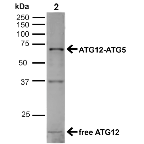 APG12 / ATG12 Antibody - Western blot analysis of Human Cervical cancer cell line (HeLa) lysate showing detection of ~15kDa ATG12 protein using Rabbit Anti-ATG12 Polyclonal Antibody. Lane 1: MW Ladder. Lane 2: Human HeLa (20 µg). Load: 20 µg. Block: 5% milk + TBST for 1 hour at RT. Primary Antibody: Rabbit Anti-ATG12 Polyclonal Antibody  at 1:1000 for 1 hour at RT. Secondary Antibody: Goat Anti-Rabbit: HRP at 1:2000 for 1 hour at RT. Color Development: TMB solution for 12 min at RT. Predicted/Observed Size: ~15kDa. Other Band(s): ATG12-ATG5 Complex.
