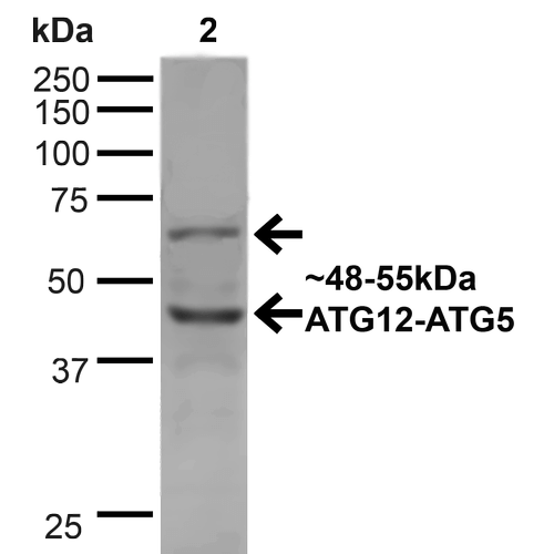 APG12 / ATG12 Antibody - Western blot analysis of Human Cervical cancer cell line (HeLa) lysate showing detection of ~48 and 55kDa ATG12 protein using Rabbit Anti-ATG12 Polyclonal Antibody. Lane 1: MW Ladder. Lane 2: Human HeLa (20 µg). Load: 20 µg. Block: 5% milk + TBST for 1 hour at RT. Primary Antibody: Rabbit Anti-ATG12 Polyclonal Antibody  at 1:1000 for 1 hour at RT. Secondary Antibody: Goat Anti-Rabbit: HRP at 1:2000 for 1 hour at RT. Color Development: TMB solution for 12 min at RT. Predicted/Observed Size: ~48 and 55kDa.