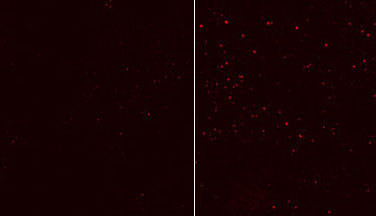 APG12 / ATG12 Antibody - Atg12 antibody tested in HEK cells. Fixed in PFA permeablilized with 0.2% Saponin. Blocked and antibodies in 10% goat serum. Secondary was mouse 555. The right is in full medium (FM) and the left with EBSS (no leupeptin)(Provided by Nicole McKnight & Sharon Tooze).