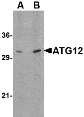 APG12 / ATG12 Antibody - Western blot of ATG12 in human brain tissue lysate with ATG12 antibody at (A) 0.5, and (B) 1 ug/ml.