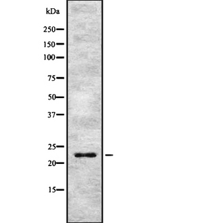 APG12 / ATG12 Antibody - Western blot analysis of ATG12 using MCF-7 whole lysates.