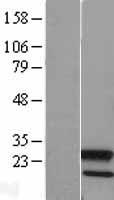 APG12 / ATG12 Protein - Western validation with an anti-DDK antibody * L: Control HEK293 lysate R: Over-expression lysate