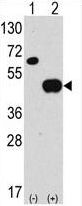 APG4B / ATG4B Antibody - Western blot of anti-hAPG4B-R31 antibody in 293 cell line lysates transiently transfected with the ATG4B gene (2 ug/lane). hAPG4B-R31(arrow) was detected using the purified antibody.