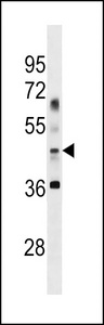 APG4B / ATG4B Antibody - APG4B Antibody (Center G254)western blot of Uterus tissue lysates (35 ug/lane). The APG4B antibody detected the APG4B protein (arrow).