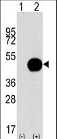 APG4B / ATG4B Antibody - Western blot of APG4B (arrow) using purified antibody. 293 cell lysates (2 ug/lane) either nontransfected (Lane 1) or transiently transfected with the APG4B gene (Lane 2) (Origene Technologies).