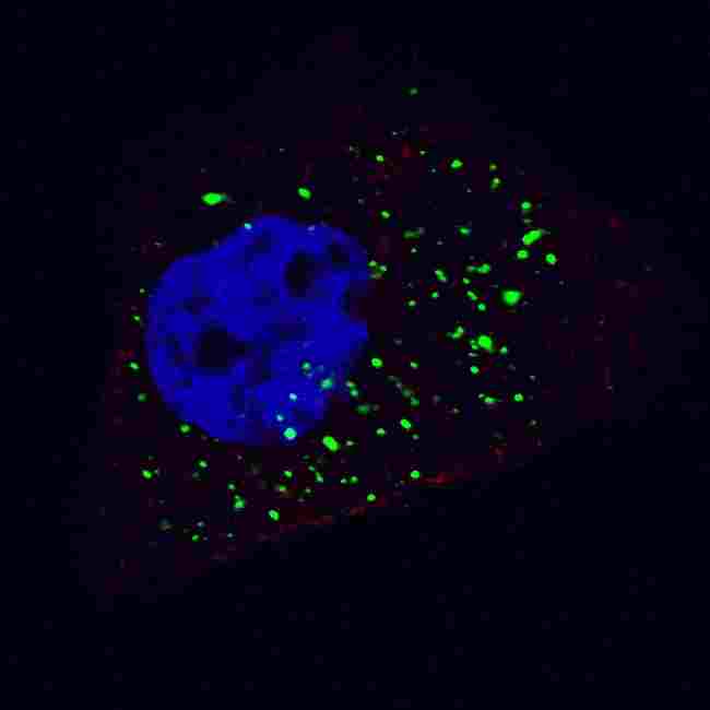 APG4B / ATG4B Antibody - Fluorescent image of U251 cells stained with ATG4B antibody. U251 cells were treated with Chloroquine (50 mu M,16h), then fixed with 4% PFA (20 min), permeabilized with Triton X-100 (0.2%, 30 min). Cells were then incubated ATG4B primary antibody (1:100, 2 h at room temperature). For secondary antibody, Alexa Fluor 488 conjugated donkey anti-rabbit antibody (green) was used (1:1000, 1h). Nuclei were counterstained with Hoechst 33342 (blue) (10 ug/ml, 5 min). ATG4B immunoreactivity is localized to autophagic vacuoles in the cytoplasm of U251 cells.