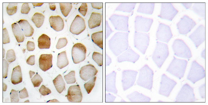 APG4B / ATG4B Antibody - Immunohistochemistry analysis of paraffin-embedded human skeletal muscle tissue, using ATG4B Antibody. The picture on the right is blocked with the synthesized peptide.