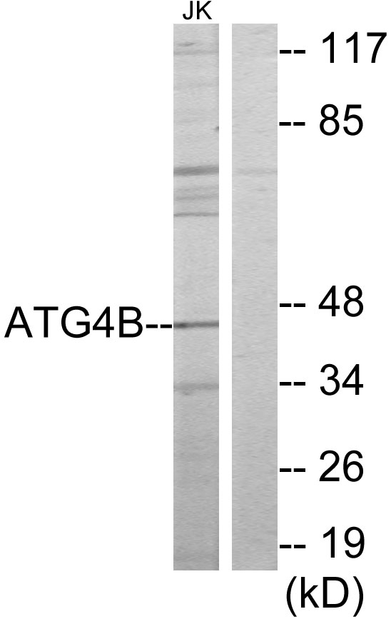 APG4B / ATG4B Antibody - Western blot analysis of lysates from Jurkat cells, using ATG4B Antibody. The lane on the right is blocked with the synthesized peptide.