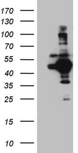 APG4B / ATG4B Antibody - HEK293T cells were transfected with the pCMV6-ENTRY control. (Left lane) or pCMV6-ENTRY ATG4B. (Right lane) cDNA for 48 hrs and lysed. Equivalent amounts of cell lysates. (5 ug per lane) were separated by SDS-PAGE and immunoblotted with anti-ATG4B. (1:2000)