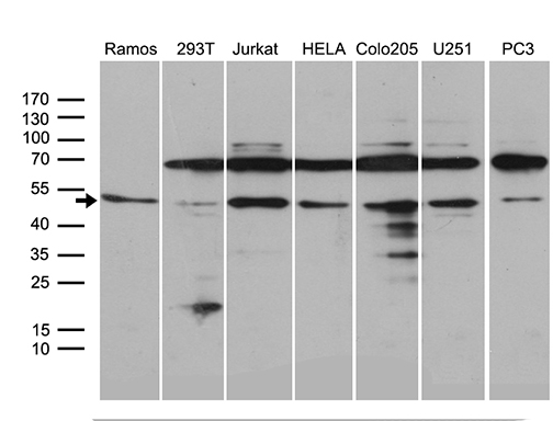 APG4B / ATG4B Antibody - Western blot analysis of extracts. (35ug) from 7 different cell lines by using anti-ATG4B monoclonal antibody. (1:500)