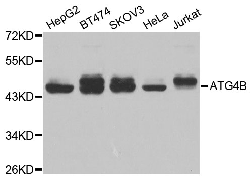 APG4B / ATG4B Antibody - Western blot analysis of extracts of various cell lines.