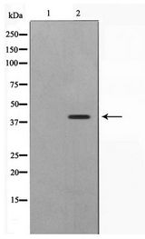 APG4B / ATG4B Antibody - Western blot of Jurkat cell lysate using ATG4B Antibody